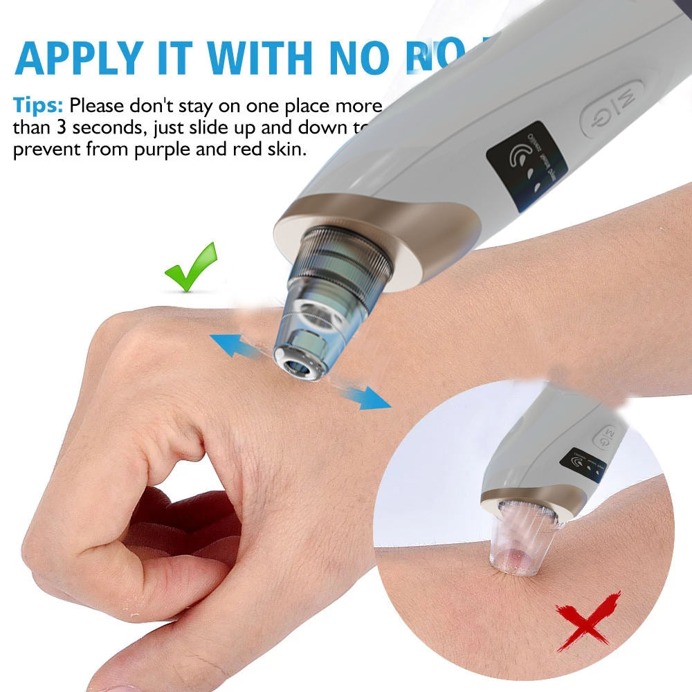 Caartup™ Deep Facial Pore Cleaner–Glow Flawless Skin