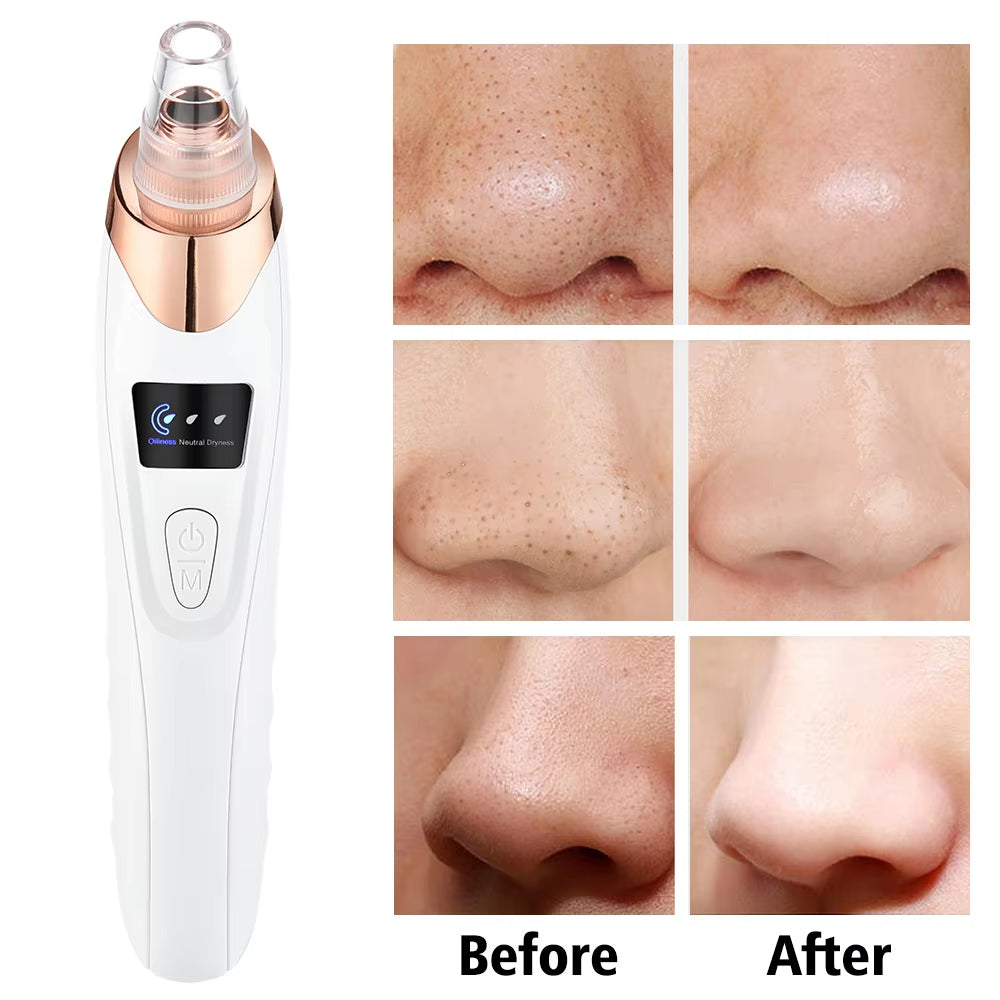 Deep Facial Pore Cleaner–Glow  Flawless Skin